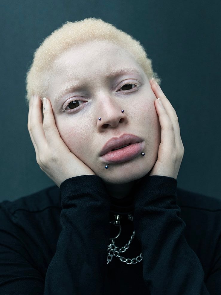 This portrait is of Nan, a person in their mid-twenties, captured in a striking close-up portrait. They are a person with albinism, shot from the shoulders up. Their short, pale blonde hair is closely cropped, and their fair skin appears luminous against a dark, neutral background.
Nan’s expression is pensive, almost melancholic. Their full lips are slightly parted, and their eyes hold a quiet intensity, as if caught in a moment of introspection. Their face is gently cradled by both hands, fingers resting along their cheeks and temples, adding to the emotional gravity of the image.
They wear a high-neck black top adorned with silver neck chains which adds a contrast, suggesting a punk flair to the otherwise raw and tender mood. Multiple facial piercings - two on the lower lip and one on each side of the nose - punctuate their features, introducing a bold contrast to the softness of their expression.